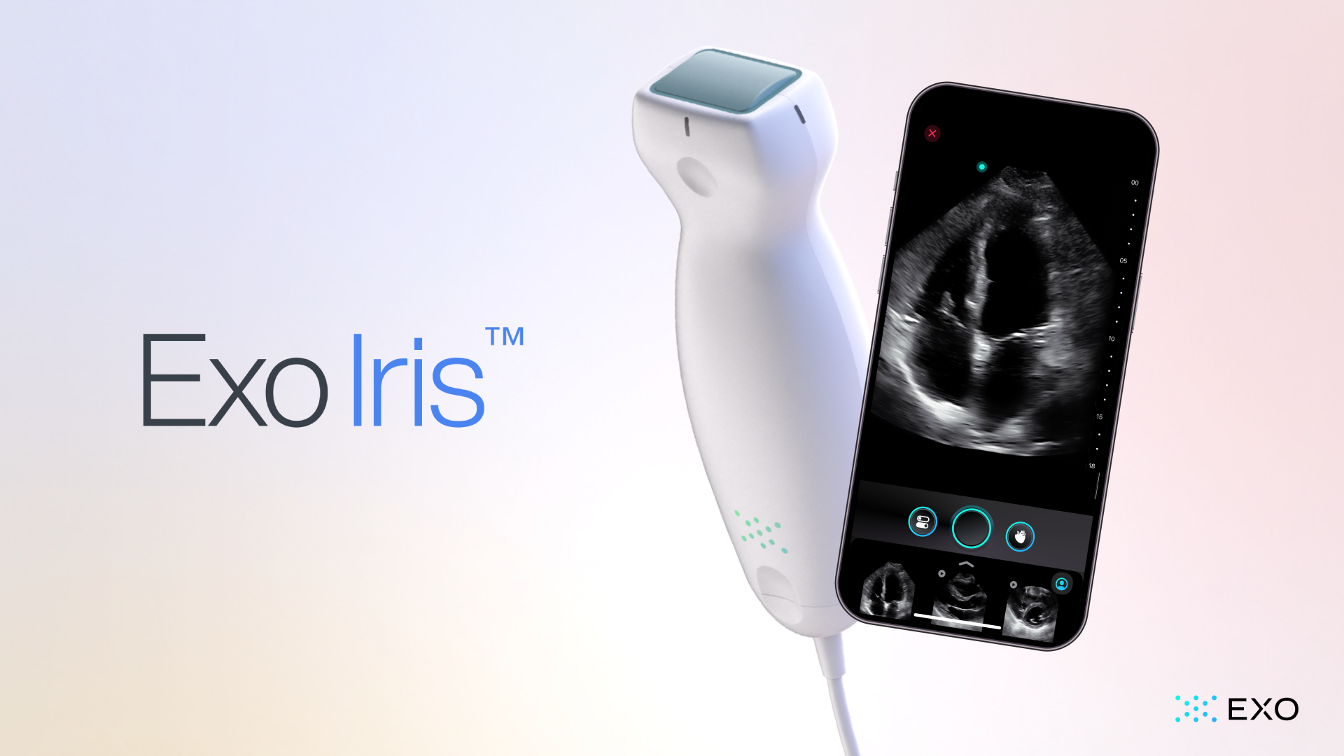 Exo Unveils Handheld Ultrasound Device